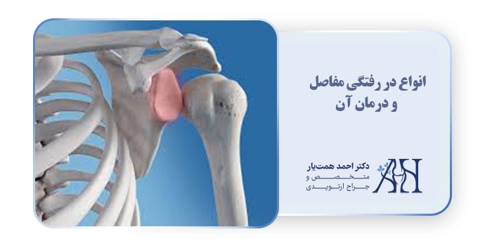 انواع در رفتگی مفاصل و درمان آن