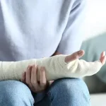 جراحی شکستگی بسته