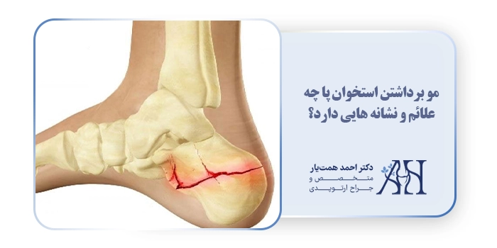 مو برداشتن استخوان پا چه علائم و نشانه هایی دارد؟