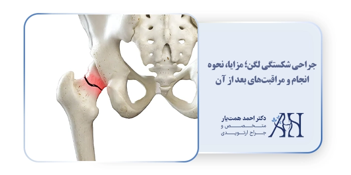جراحی شکستگی لگن؛ مزایا، نحوه انجام و مراقبت‌های بعد از آن