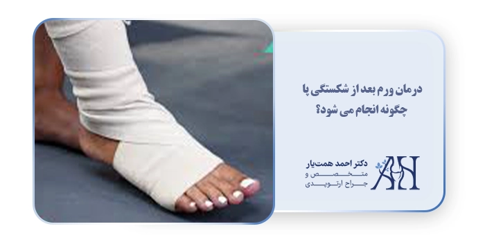 درمان ورم بعد از شکستگی پا چگونه انجام می شود؟