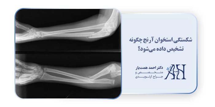 شکستگی استخوان آرنج چگونه تشخیص داده می‌شود؟