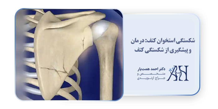 شکستگی استخوان کتف: درمان و پیشگیری از شکستگی کتف