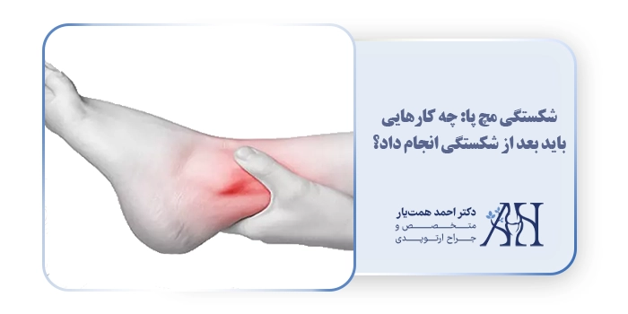 شکستگی مچ پا: چه کارهایی باید بعد از شکستگی انجام داد؟