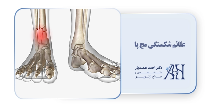 علائم شکستگی مچ پا