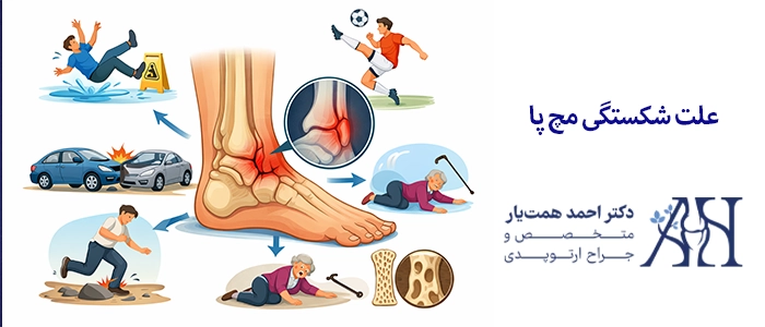 علت شکستگی مچ پا
