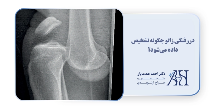 دررفتگی زانو چگونه تشخیص داده می‌شود؟