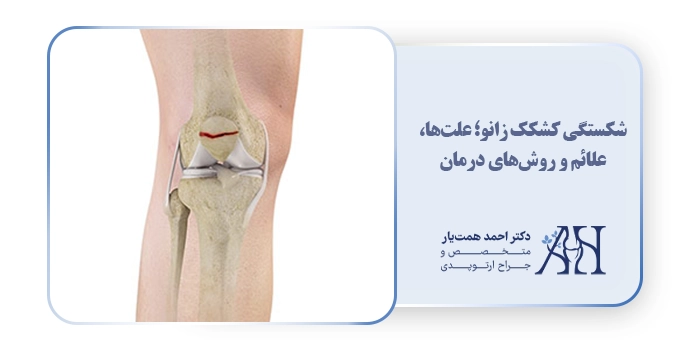 شکستگی کشکک زانو؛ علت‌ها، علائم و روش‌های درمان