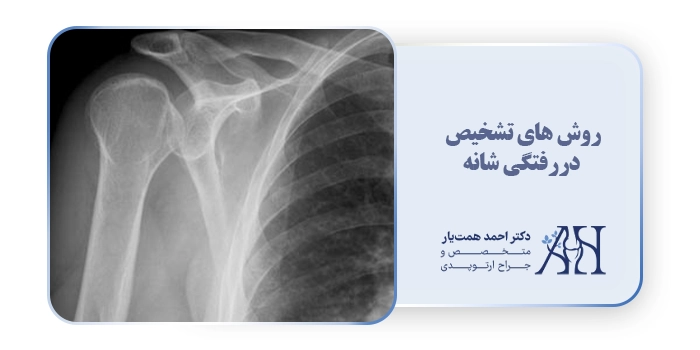 روش های تشخیص دررفتگی شانه