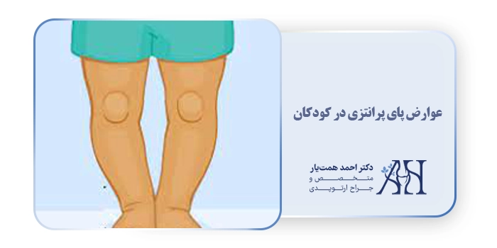 عوارض پای پرانتزی در کودکان