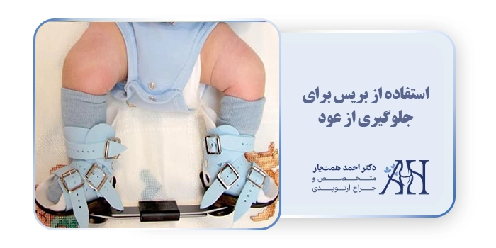 استفاده از بریس برای جلوگیری از عود