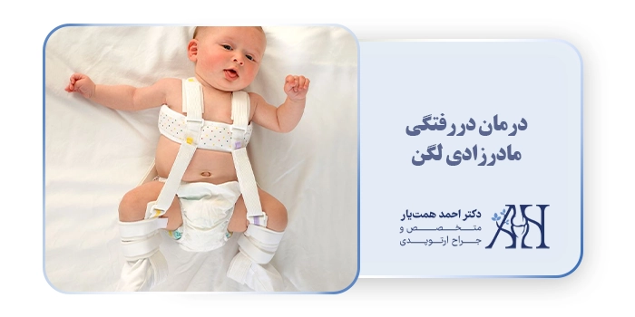 درمان دررفتگی مادرزادی لگن