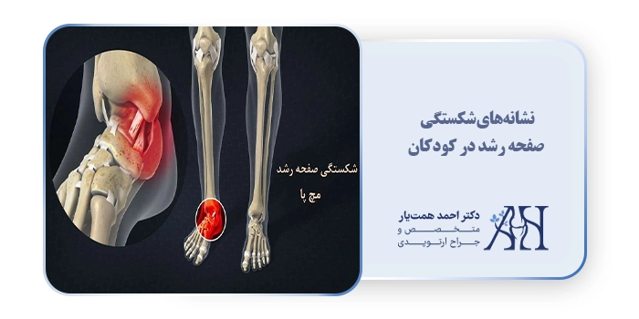 نشانه‌های شکستگی صفحه رشد در کودکان