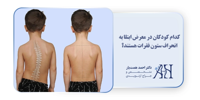 کدام کودکان در معرض ابتلا به انحراف ستون فقرات هستند؟