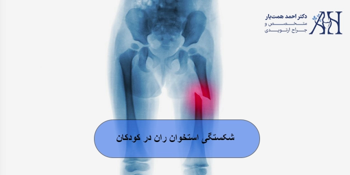 شکستگی استخوان ران در کودکان: علل، علائم و درمان