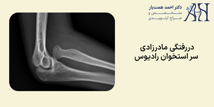 دررفتگی مادرزادی سر استخوان رادیوس